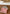 Bandeau de soin + 2 lingettes vichy